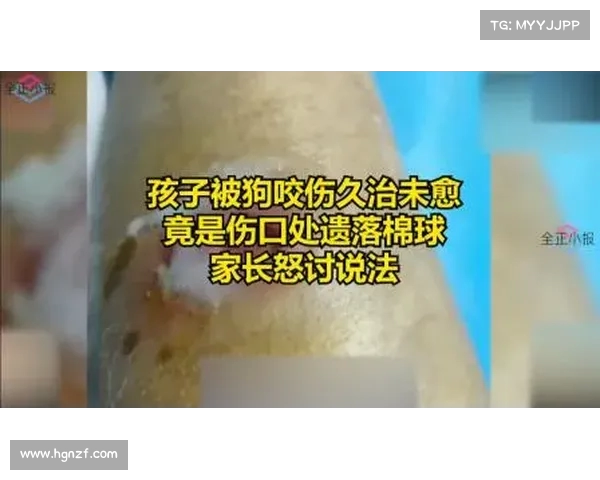 狗咬孩子,家长上门,三口被狗主打倒 狗咬孩子,家长上门,三口被狗主打倒